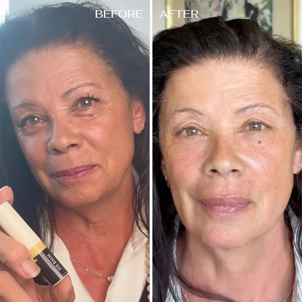 ALL-IN-ONE BALM FOR UNDER-EYE RENEWAL