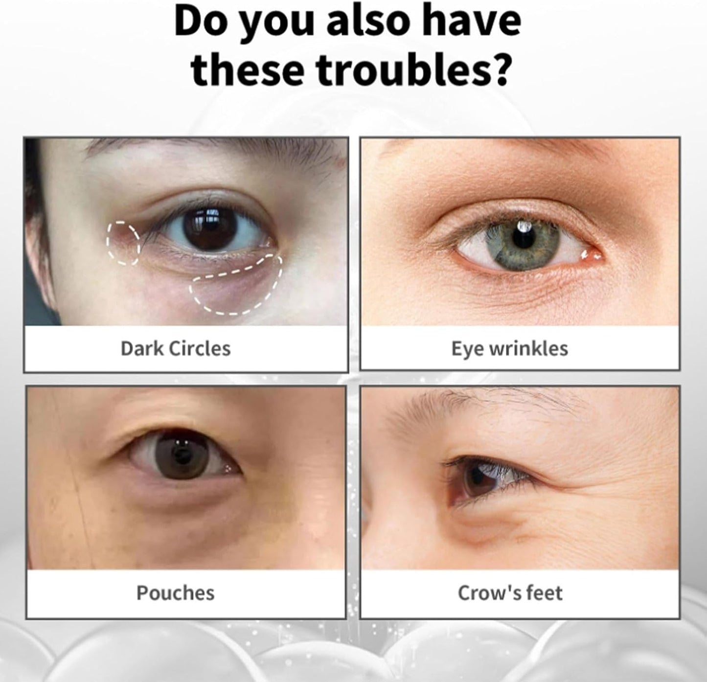 Eye Cream, Eliminates eye bags & wrinkles