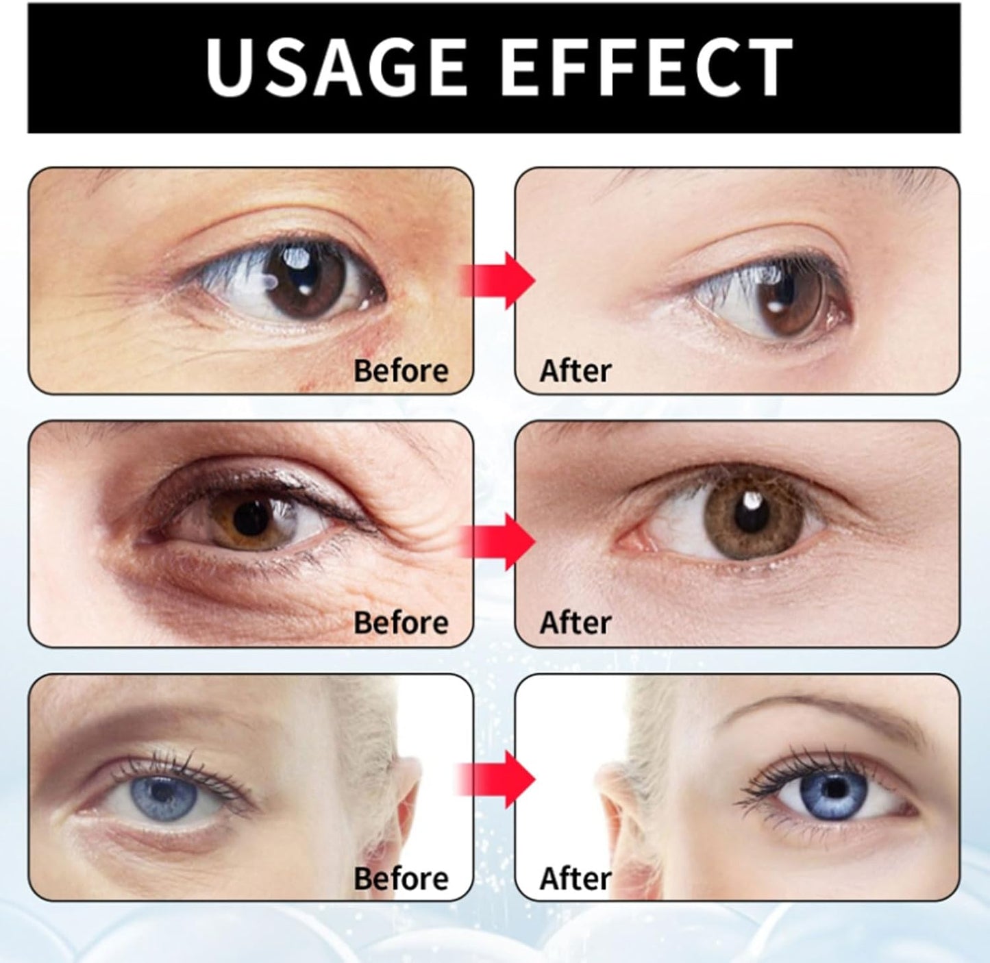 Eye Cream, Eliminates eye bags & wrinkles