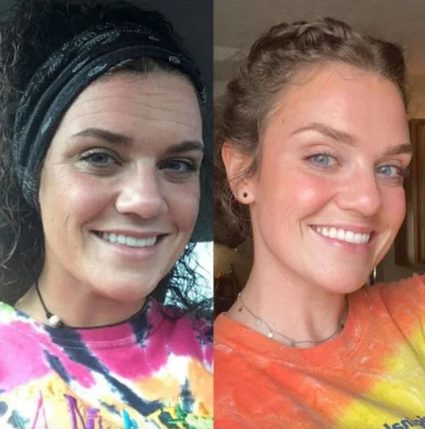 🔥Buy 1 Get 1 Free🔥Beauty Patches