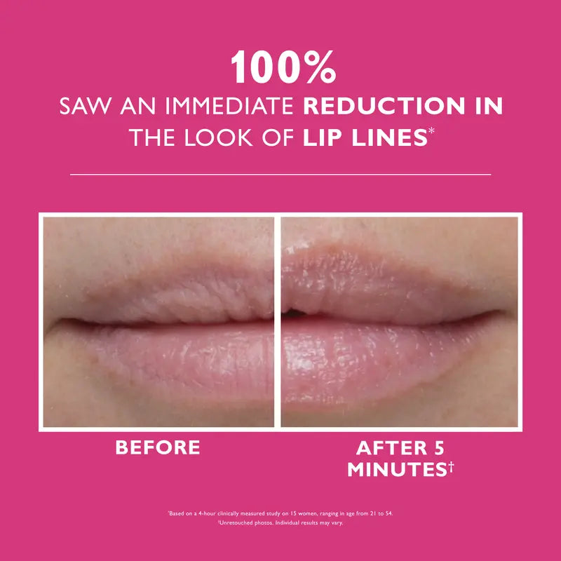 Lip Filler, Smooth and Hydrate Lips, Plumping Effect Lip Treatment, Hydrating Lip Treatment