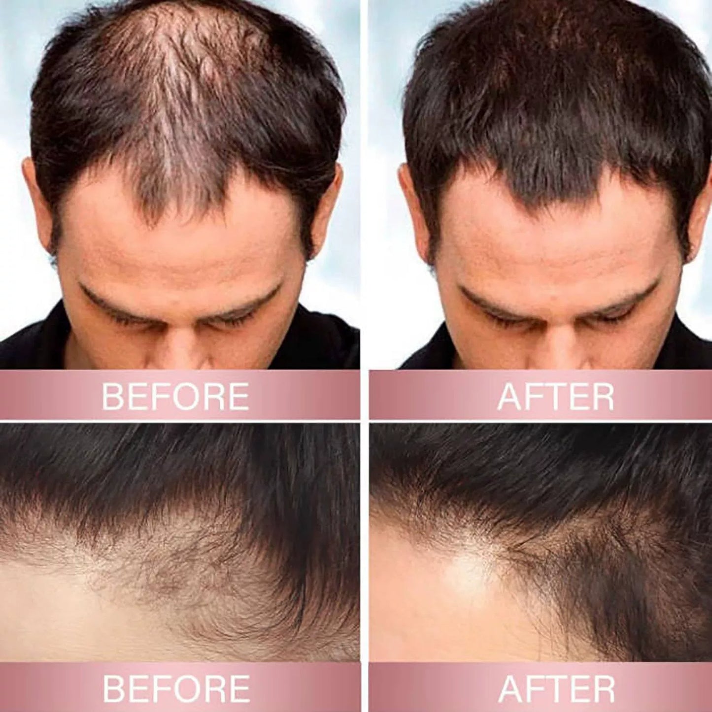 Stimulating Scalp and Hair Balm