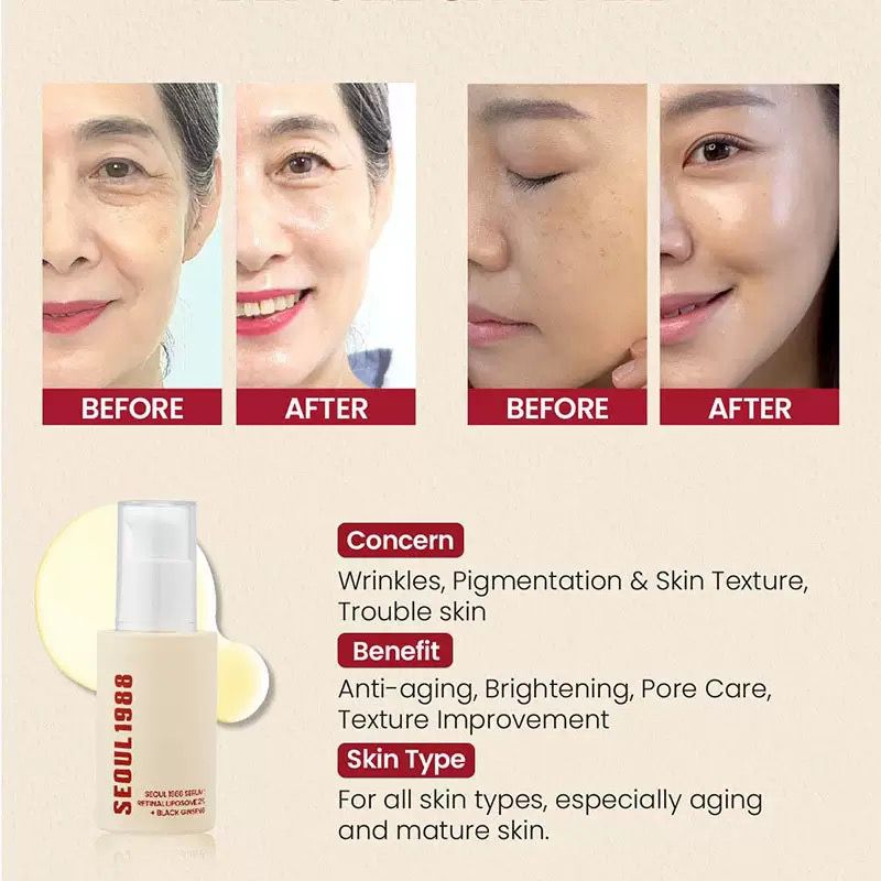 SEOUL 1988 Miracle Serum – One Bottle, Endless Skin Fixes!