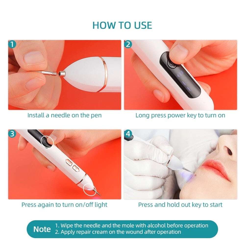 At-Home Laser Mole & Freckle Remover Pen – Traceless Spot Treatment