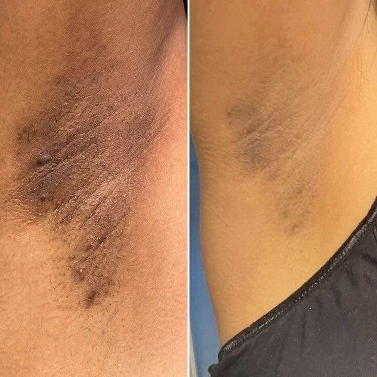 Turmeric & Kojic Acid Body Cream