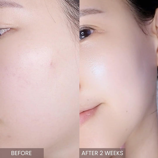 ✨ "Pink Tea Tree CICA Cream | Centella+Allantoin, Korean Glass Skin Secret 50g"