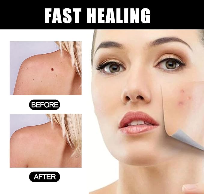 Anti Aging Moisturizer Face Cream for Women & Men,Whitening and Freckle Removing Essence