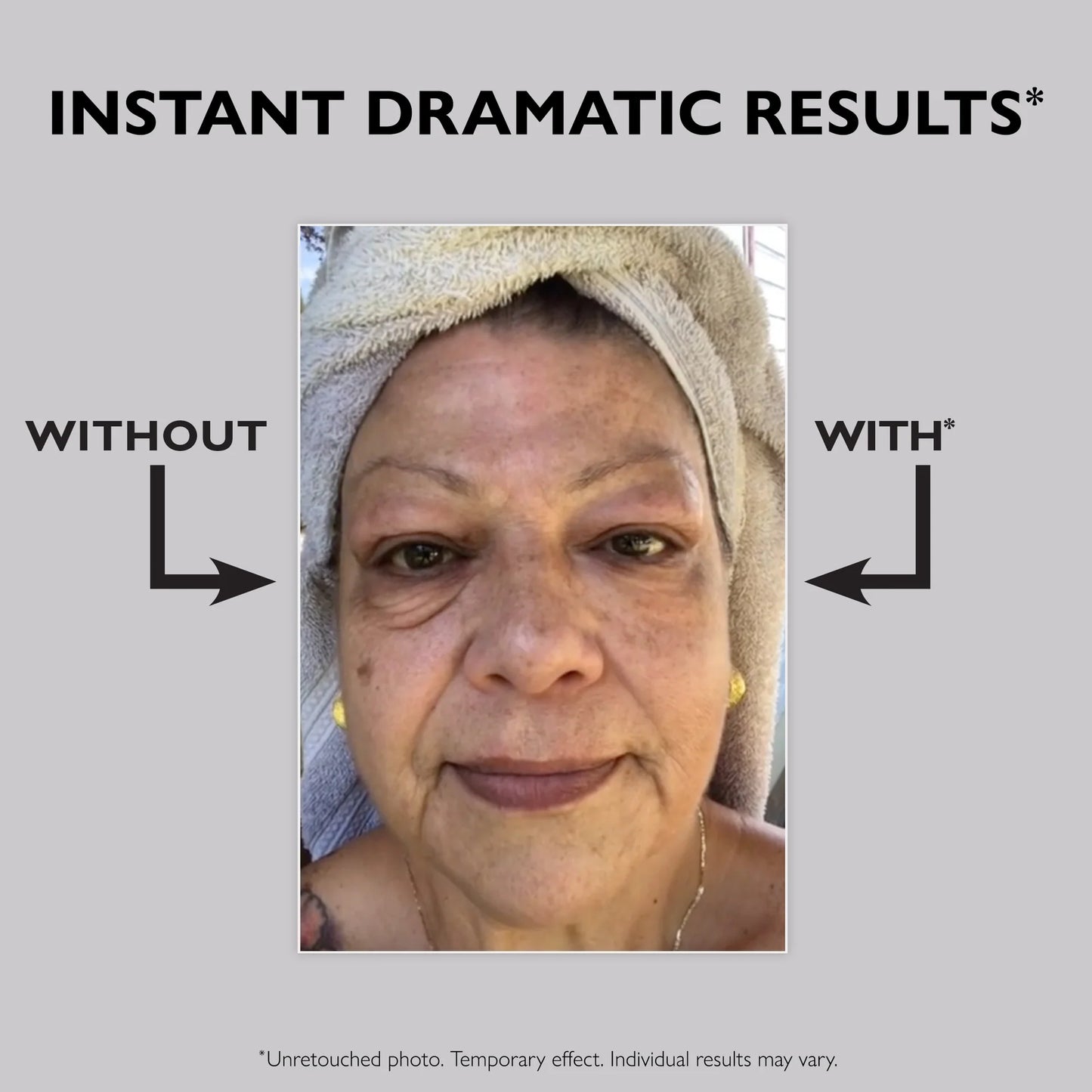 Eye Temporary Eye Tightener