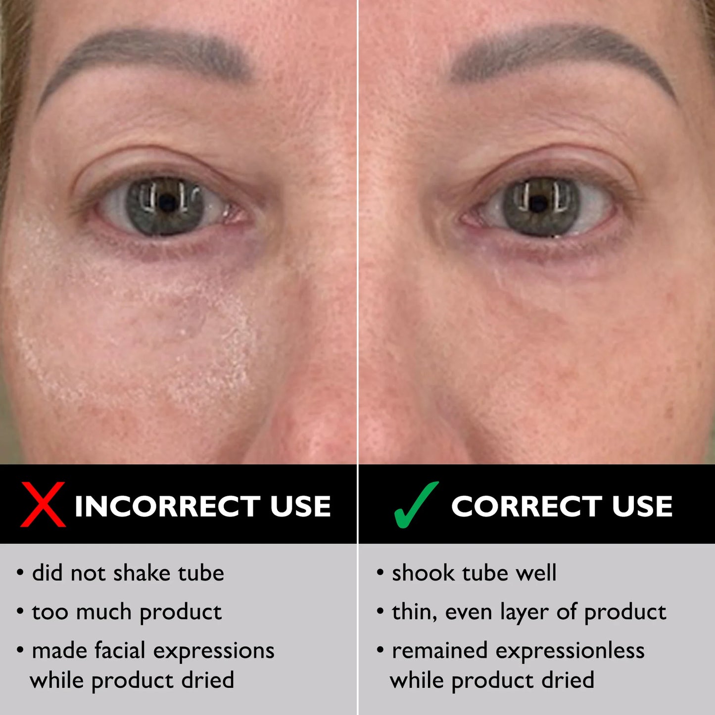 Eye Temporary Eye Tightener