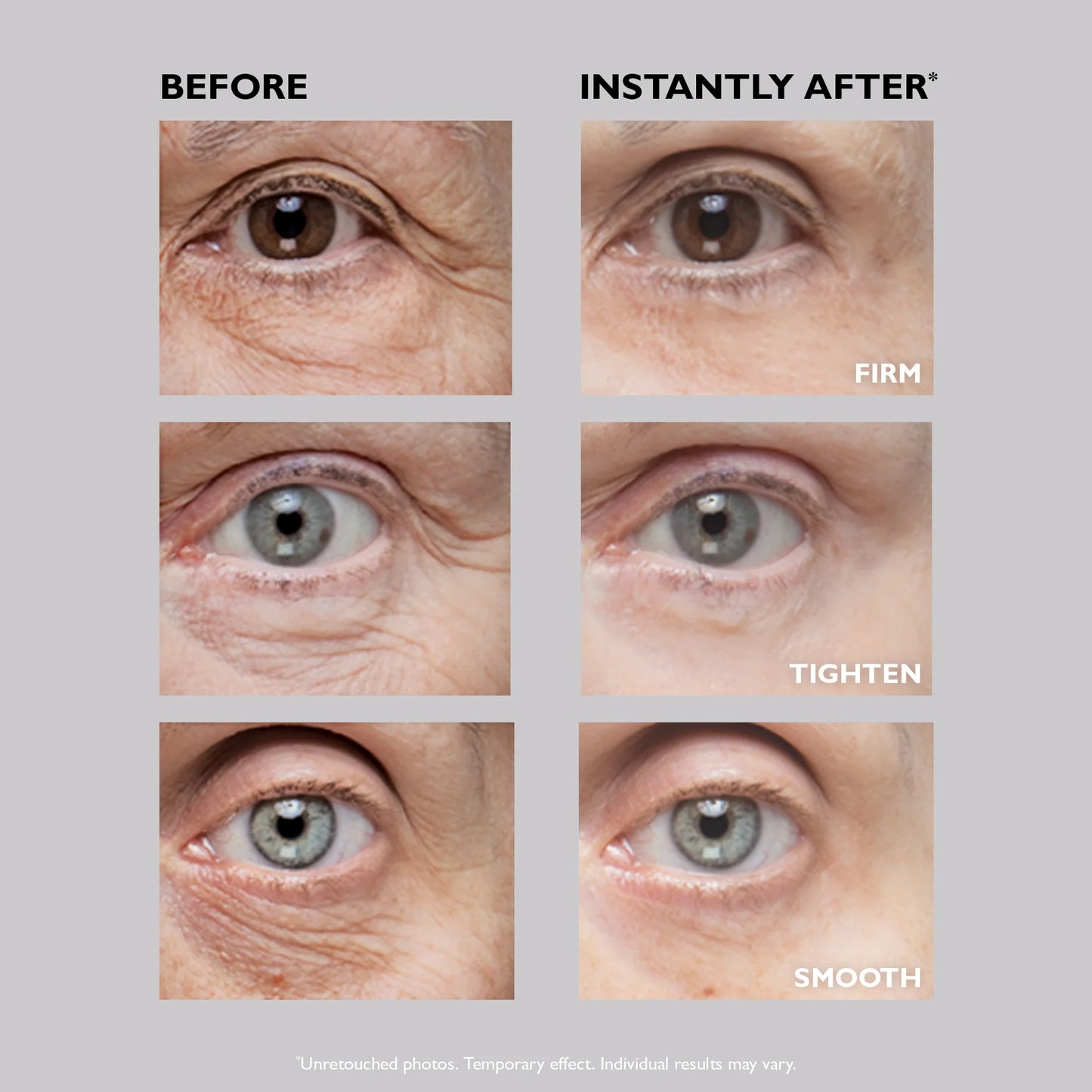 Eye Temporary Eye Tightener