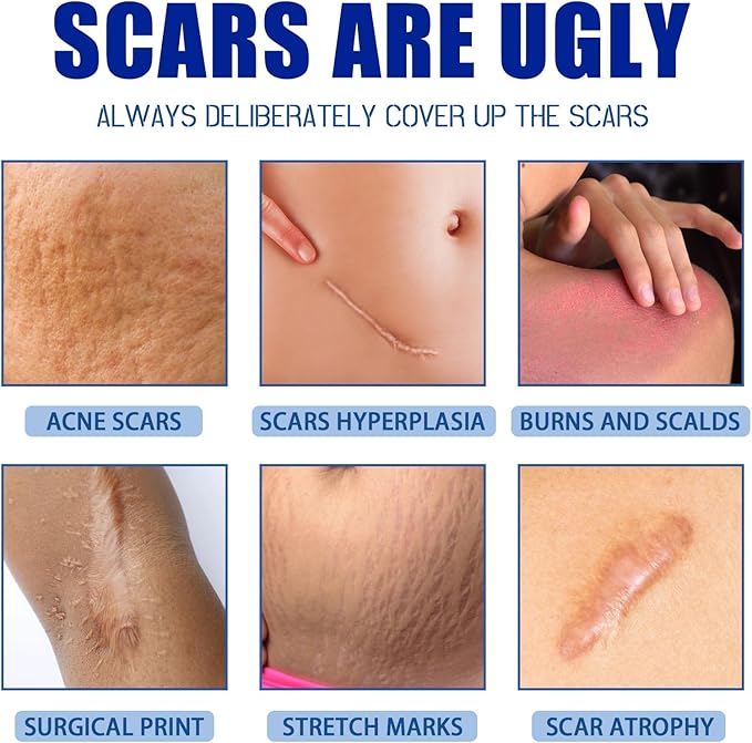 Surgeon-Recommended Scar Gel ✨ Fades Keloids & Stretch Marks Fast