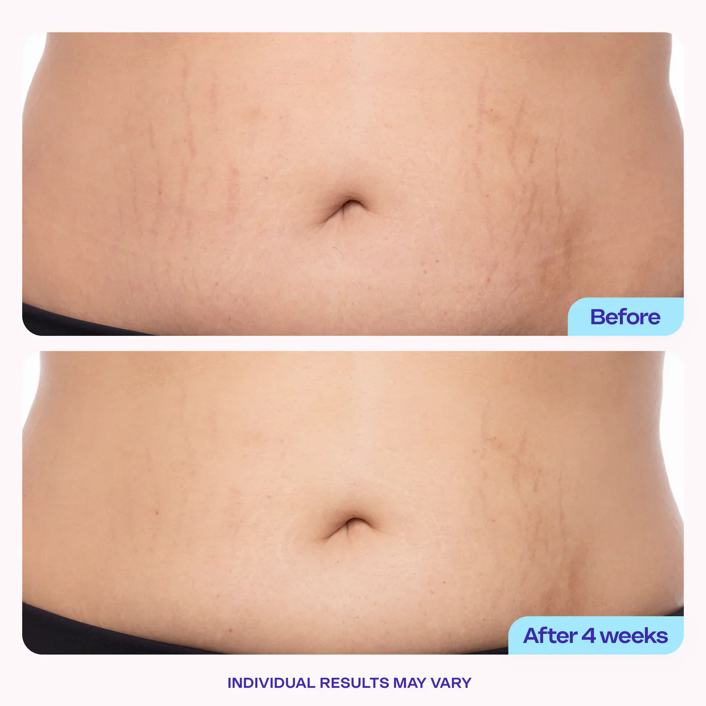 Tighten and Smooth Belly Cream