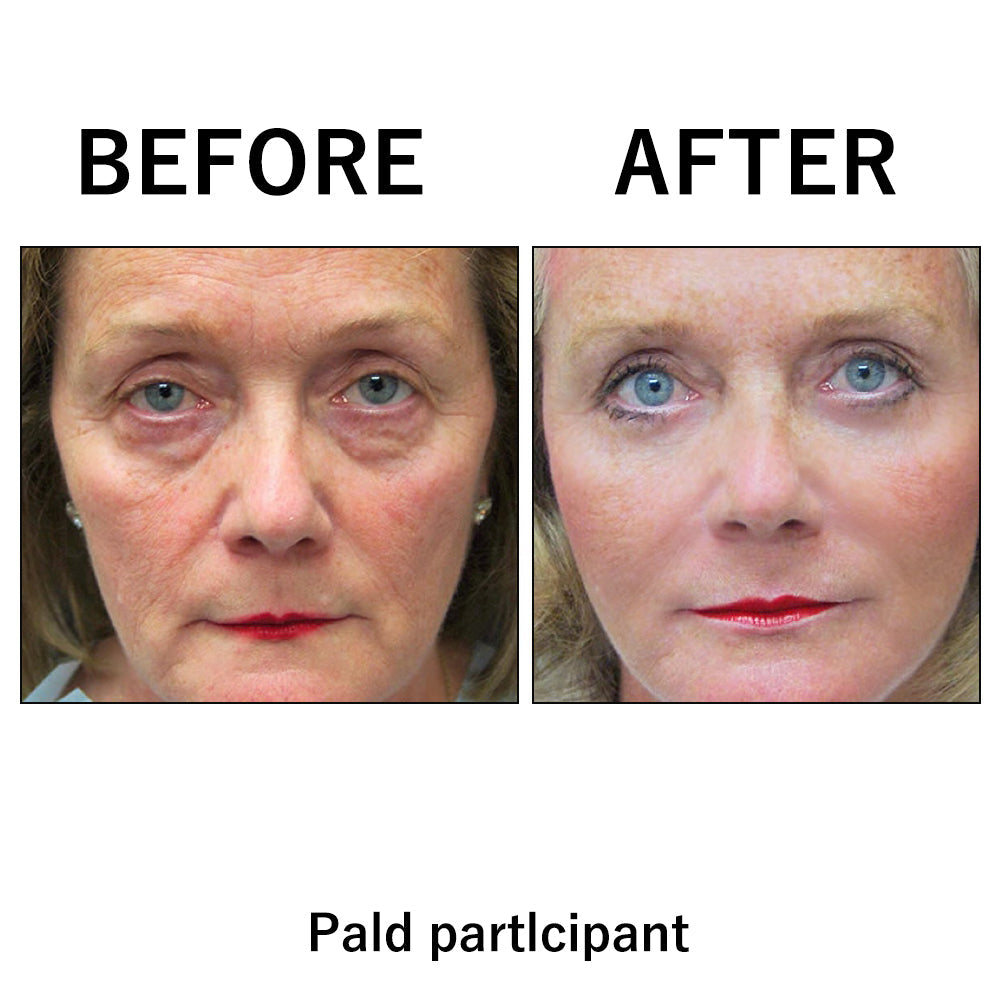 🔥 Last Day Discount 🔥Instant Temporary Face Tightener