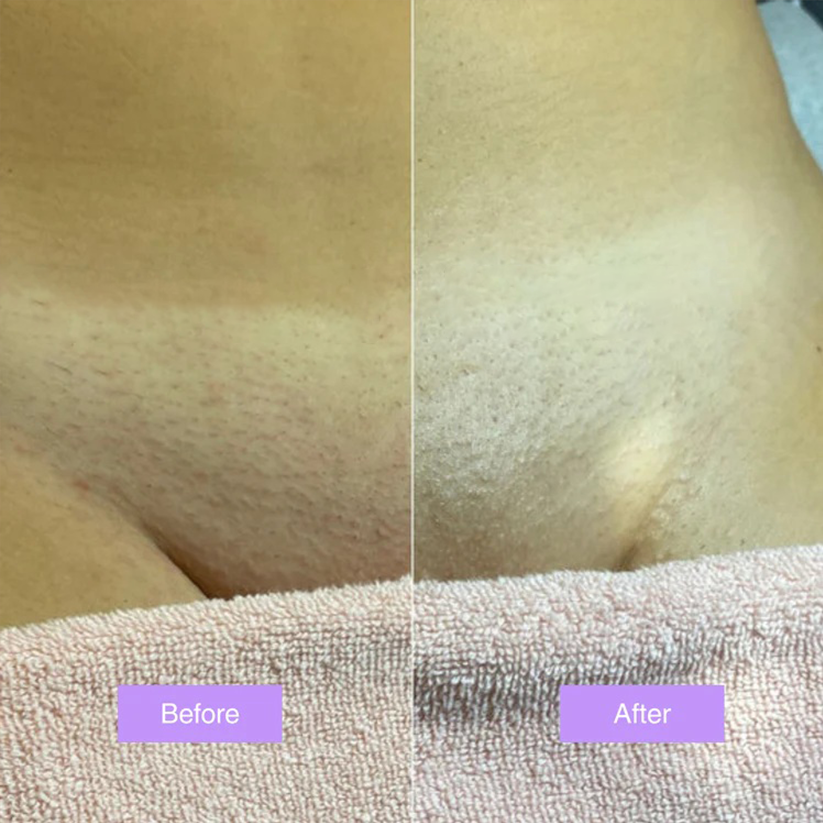 Cyperus Rotundus Skin Serum