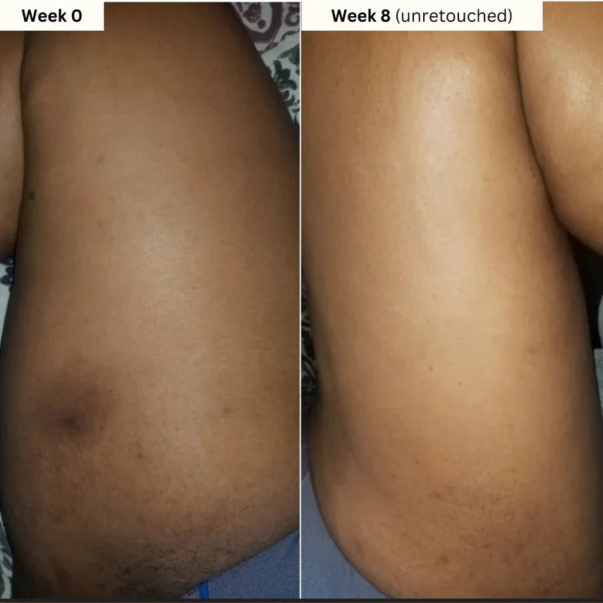 Turmeric & Kojic Acid Body Cream