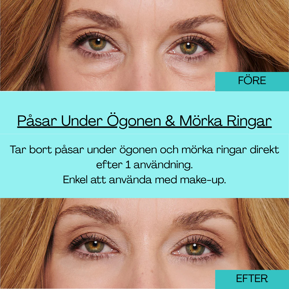 Eye Cream, Eliminates eye bags & wrinkles