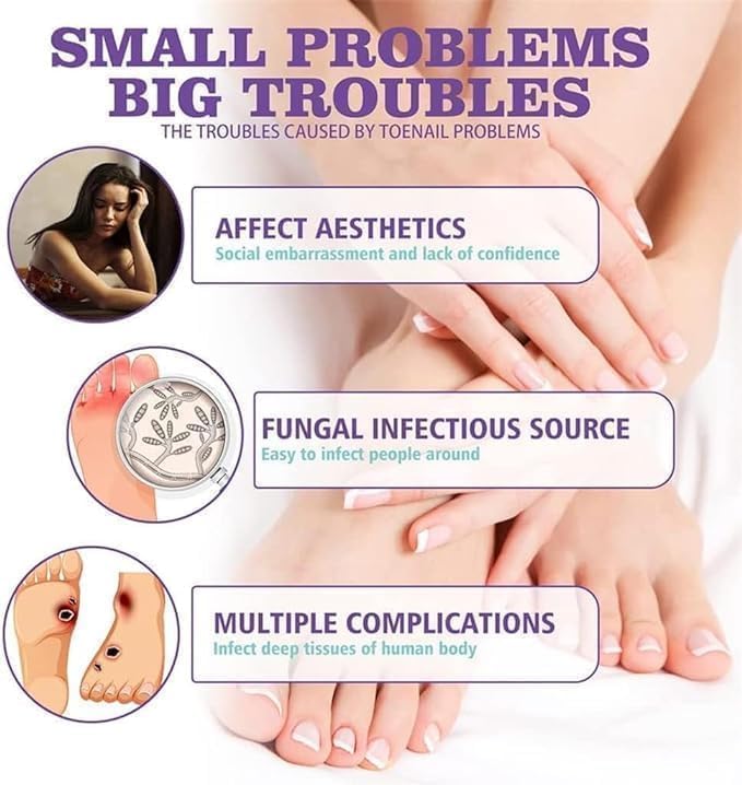 🔥Limited time offer 🔥PLANT-BASED ANTI-FUNGAL SPRAY (Clinically Approved)