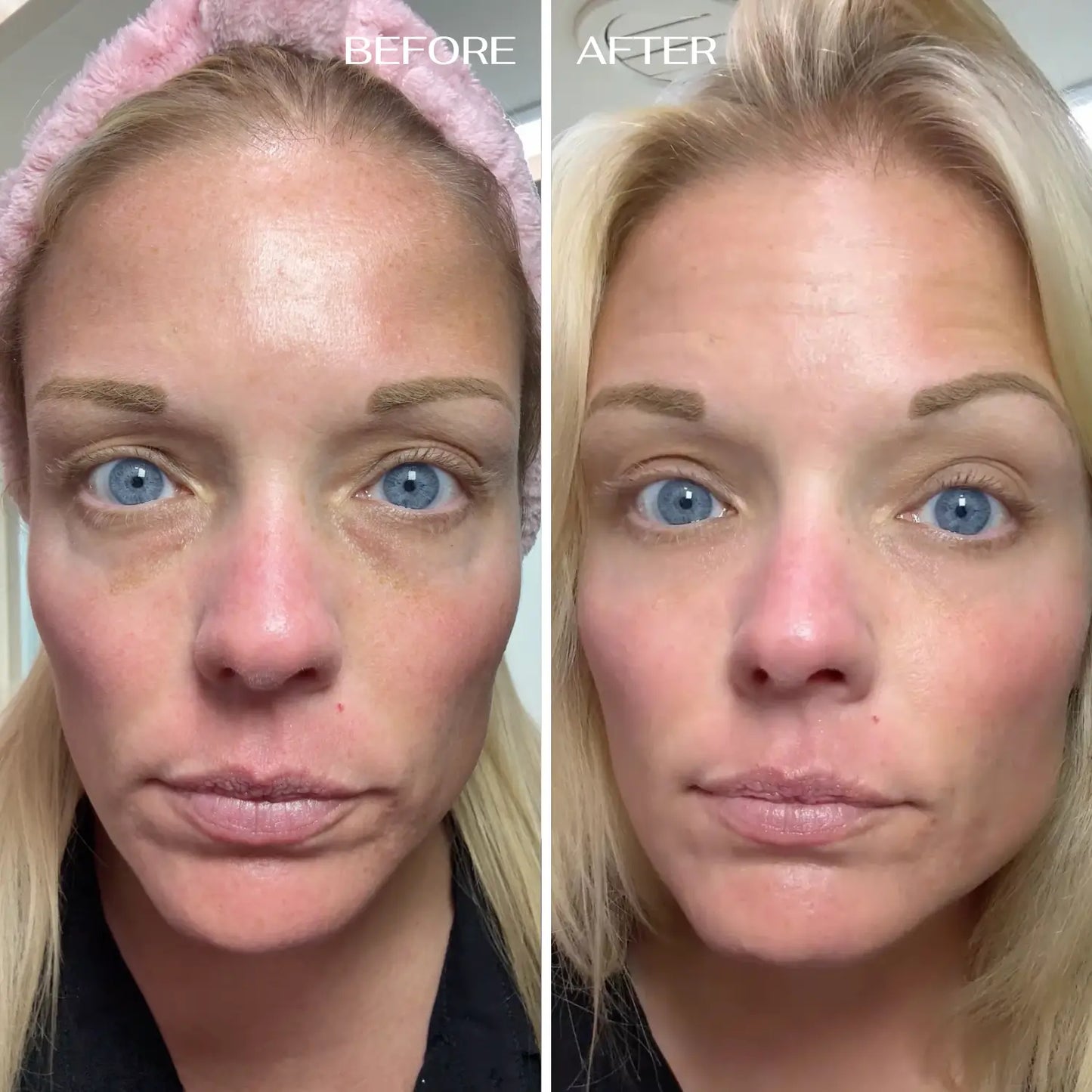 ALL-IN-ONE BALM FOR UNDER-EYE RENEWAL