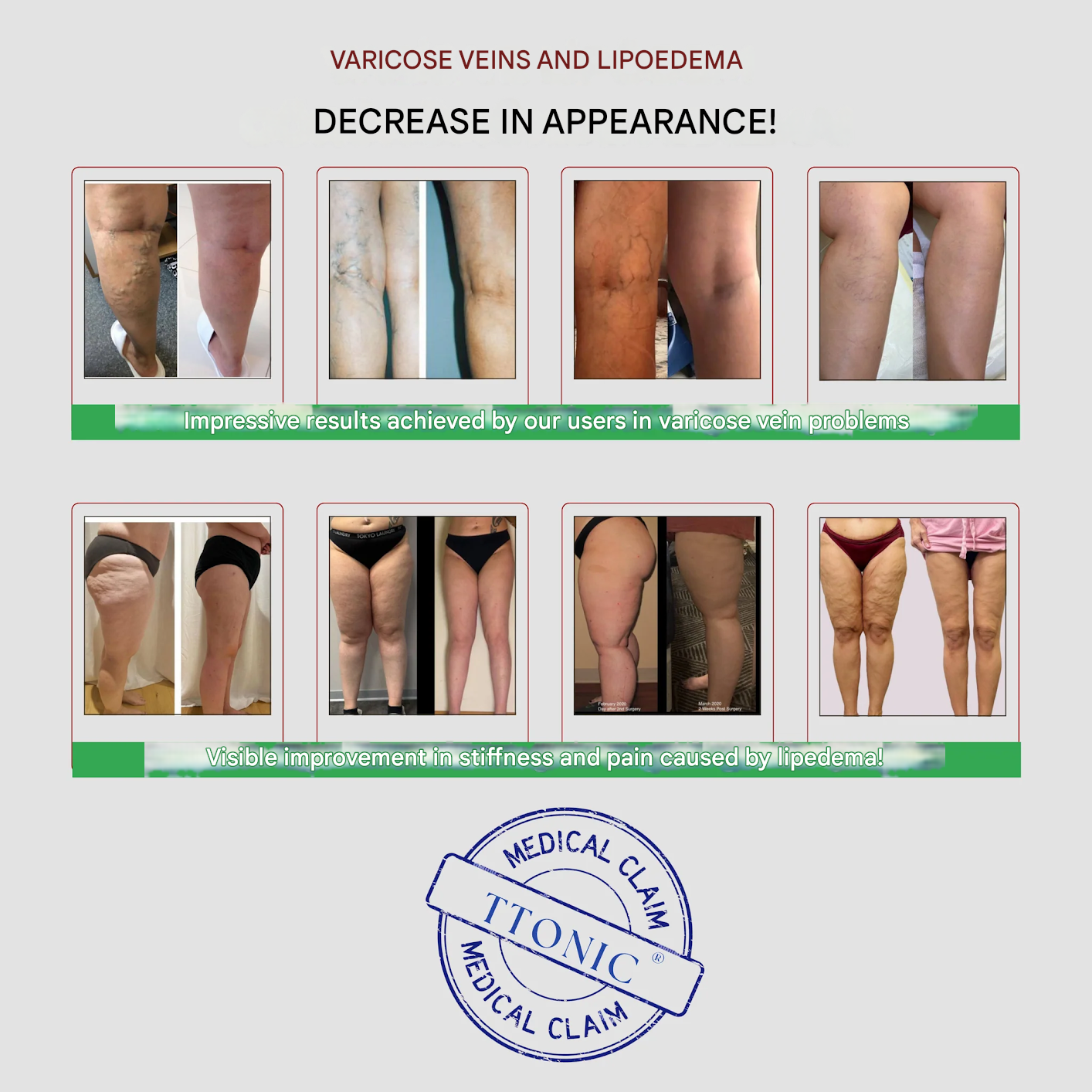 Women's Anti-Cellulite Massaging 3D Leggings