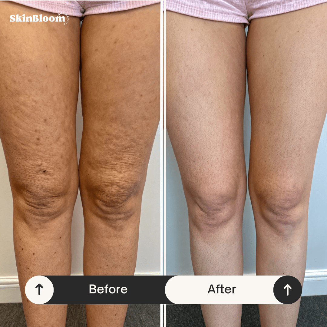 Lifting Body Oil – Miracle