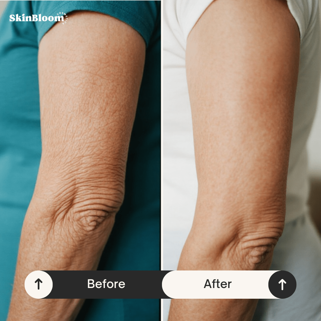 Lifting Body Oil – Miracle