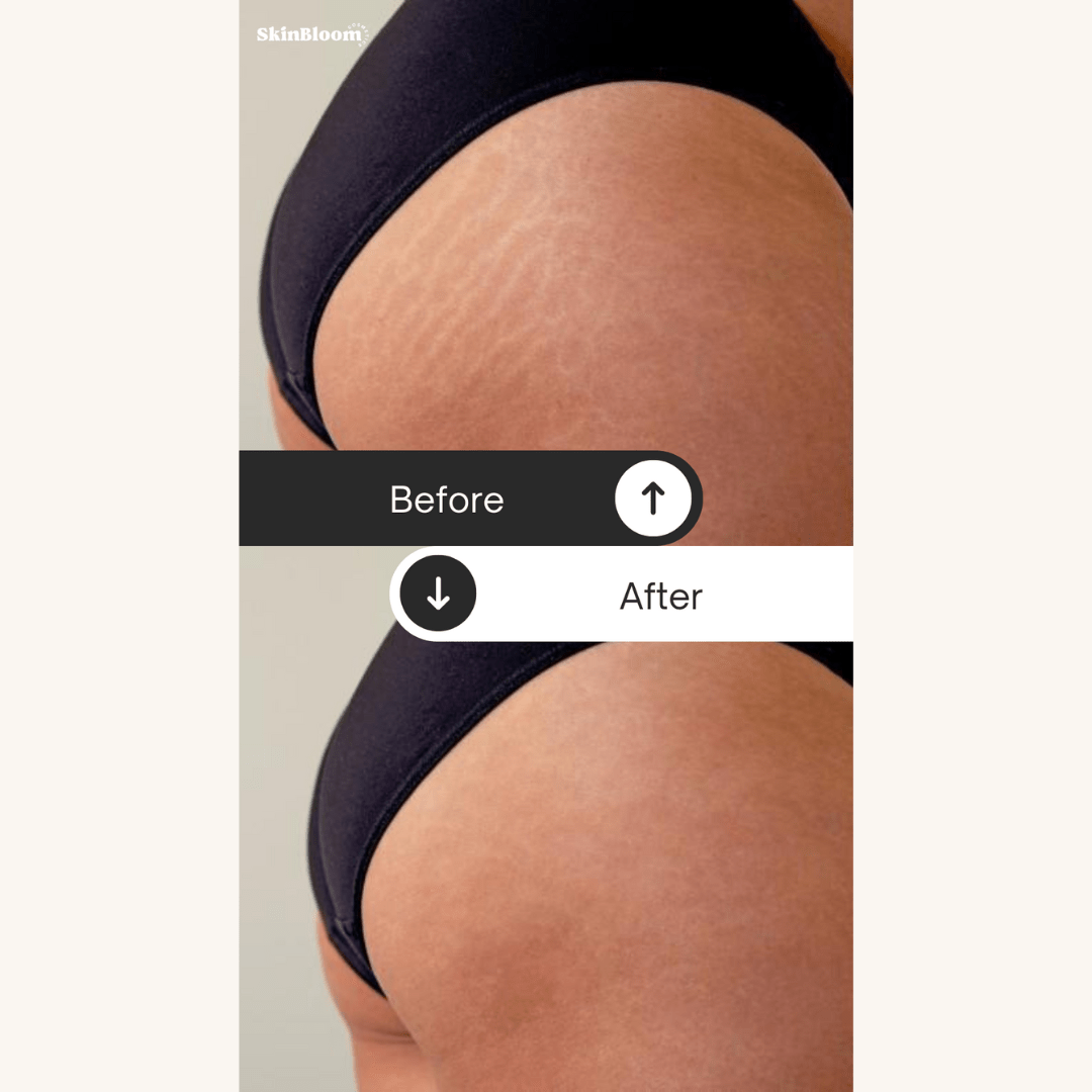 Lifting Body Oil – Miracle