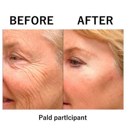 🔥 Last Day Discount 🔥Instant Temporary Face Tightener