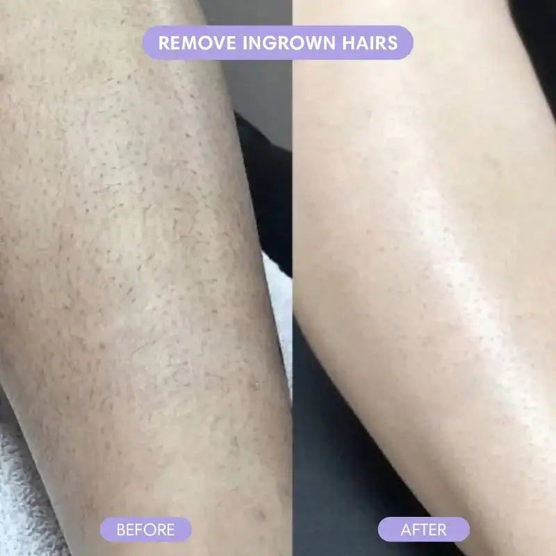 Bracurve™ Crystal Hair Eraser