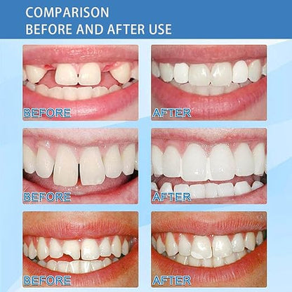 ✨ "Instant Smile Fix! Dental Repair Granules – Temporarily Fill Gaps & Secure Dentures in Minutes (30g, Energy Class A)" ✨