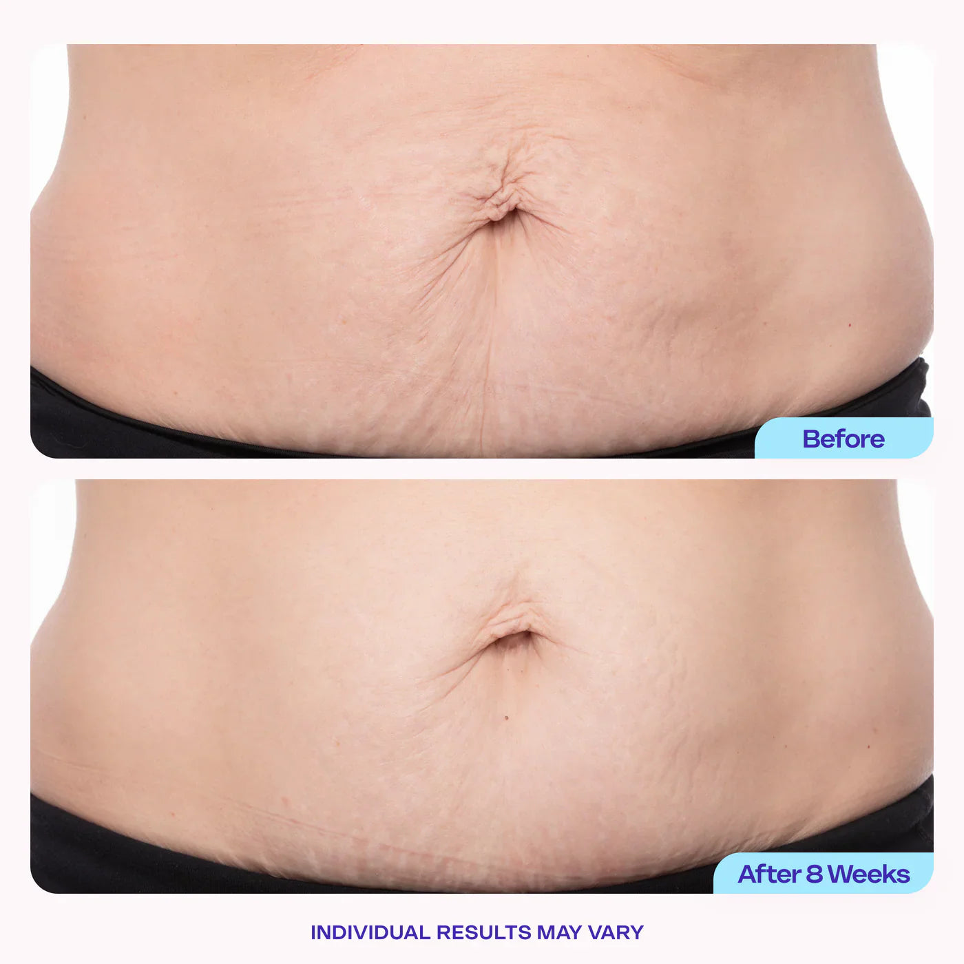 Tighten and Smooth Belly Cream
