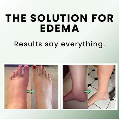 Joint Relief Balm – Natural Pain Relief for Muscles & Arthritis