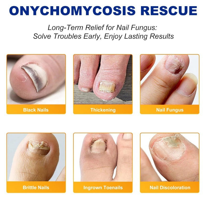 Fungal Nail Treatment Patches | 32 Count 🍄 8-Hour Overnight Repair 💤✨ Advanced Hydrogel Technology 💧🔬