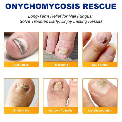 Fungal Nail Treatment Patches | 32 Count 🍄 8-Hour Overnight Repair 💤✨ Advanced Hydrogel Technology 💧🔬