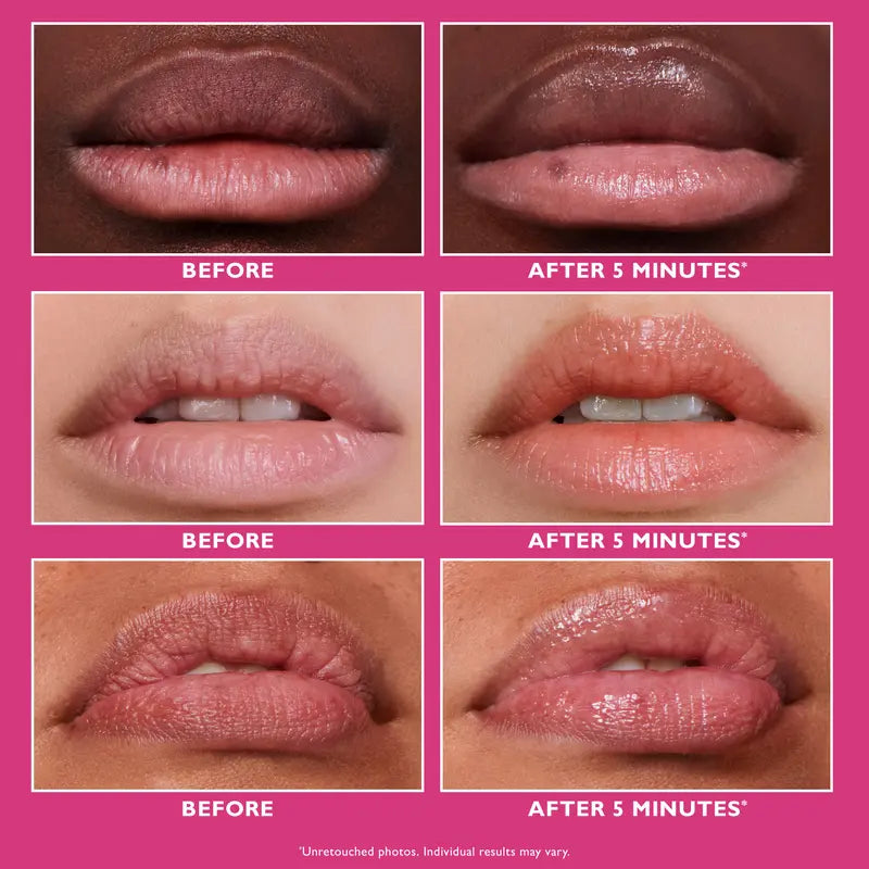 Lip Filler, Smooth and Hydrate Lips, Plumping Effect Lip Treatment, Hydrating Lip Treatment