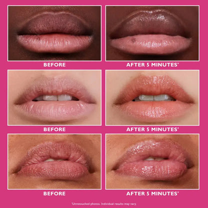 Lip Filler, Smooth and Hydrate Lips, Plumping Effect Lip Treatment, Hydrating Lip Treatment