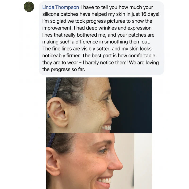 🔥Buy 1 Get 1 Free🔥Beauty Patches