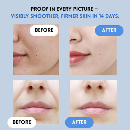 Microcrystalline Laugh Line Lifting Mask