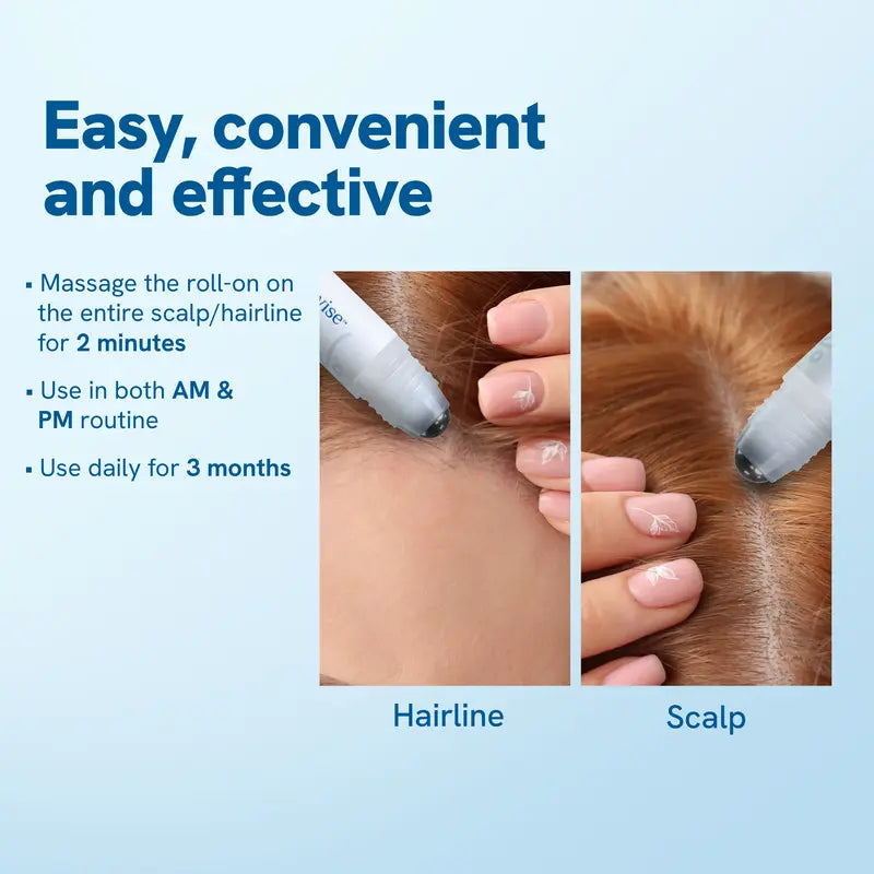 ⭐⭐Final 4 Hours: Second Item for Only $5! 🔥 Hair Growth Roll-On Serum – See hair growth in 4 weeks