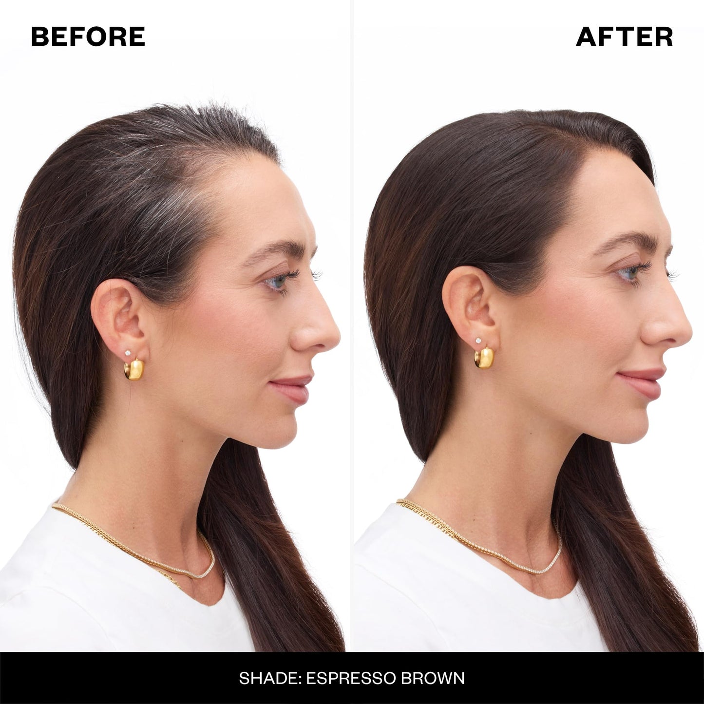 ✨Scalp Touch-Up Spray🧴Gray Hair Remover Spray