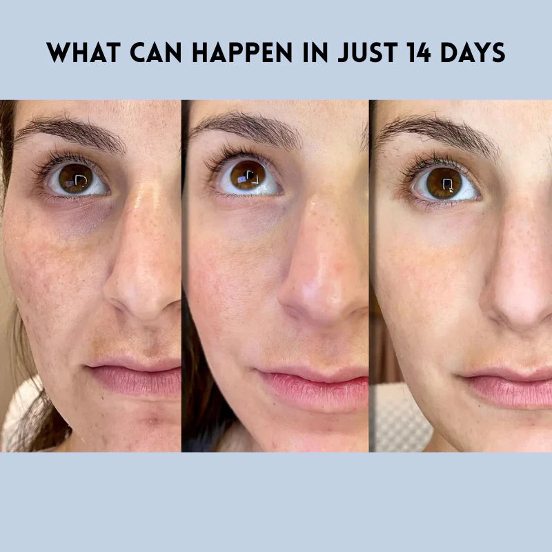 Microcrystalline Laugh Line Lifting Mask