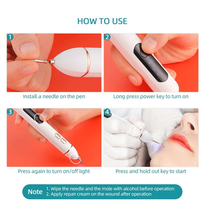 At-Home Laser Mole & Freckle Remover Pen – Traceless Spot Treatment
