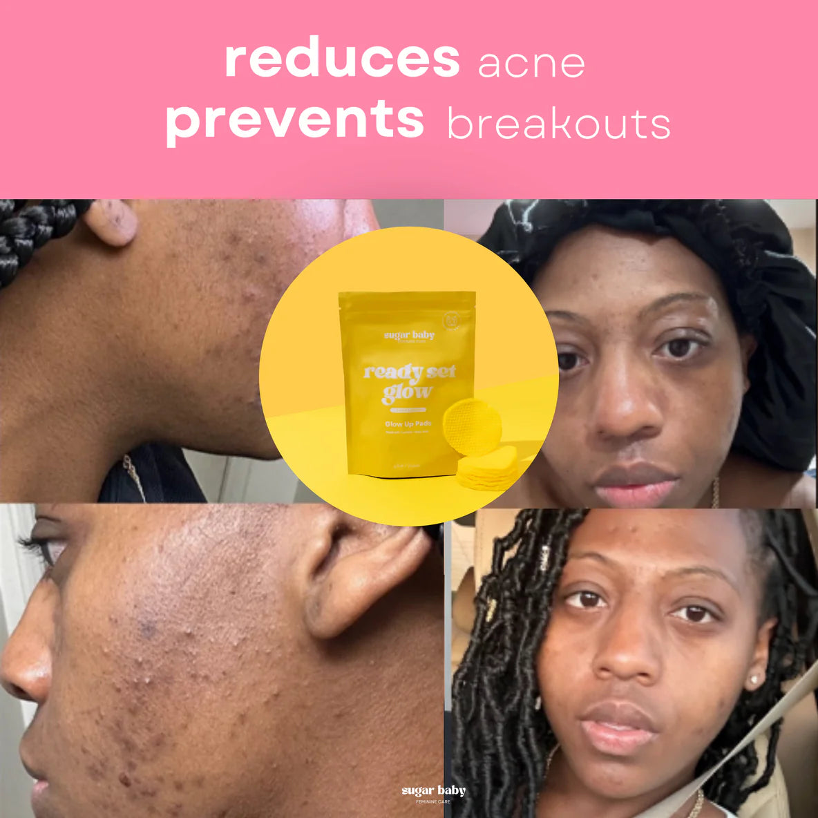 Glass Skin Kit + FREE Glow Serum