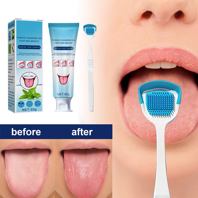 1 SET (Gel + Scraper)