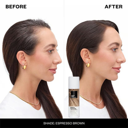 ✨Scalp Touch-Up Spray🧴Gray Hair Remover Spray