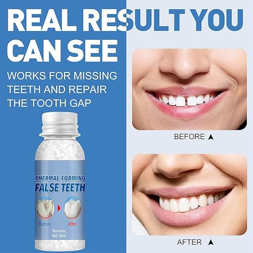 ✨ "Instant Smile Fix! Dental Repair Granules – Temporarily Fill Gaps & Secure Dentures in Minutes (30g, Energy Class A)" ✨