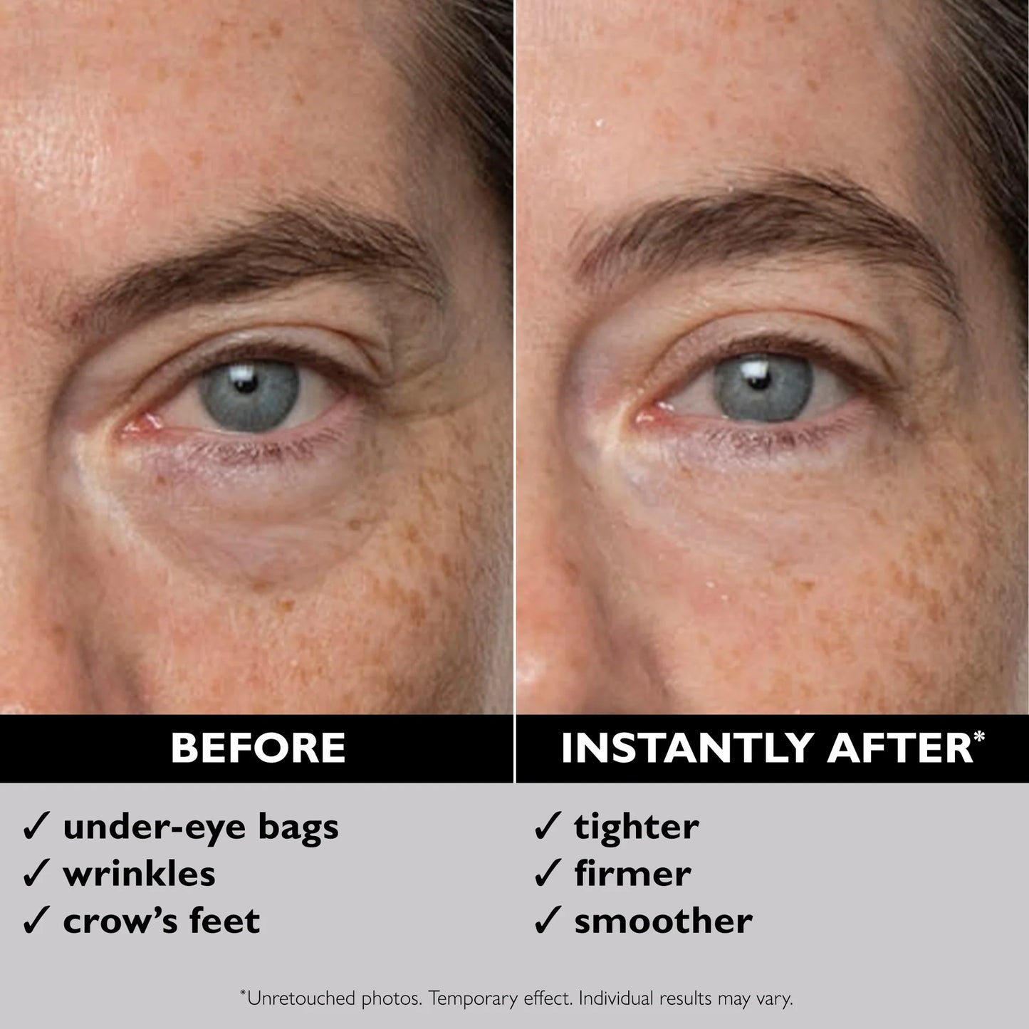 Eye Temporary Eye Tightener
