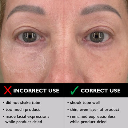 Eye Temporary Eye Tightener