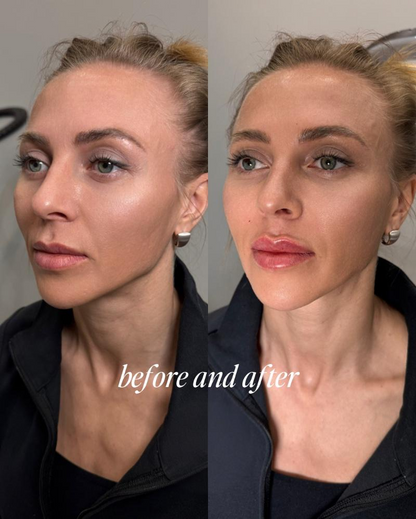 Lip Plumper gloss lips