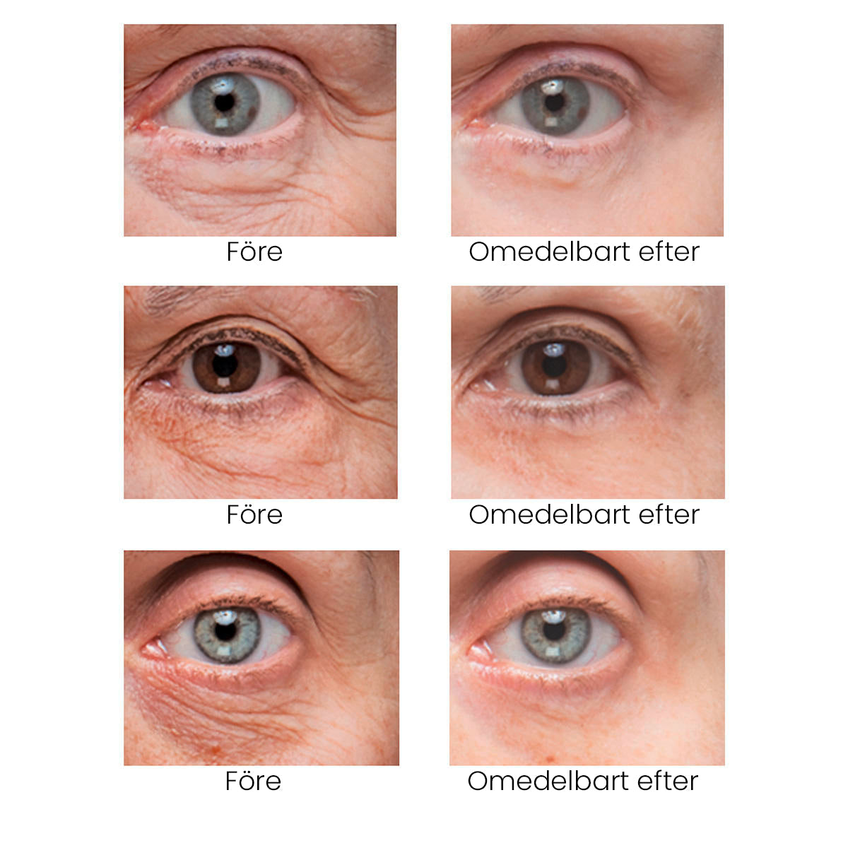 Eye Cream, Eliminates eye bags & wrinkles