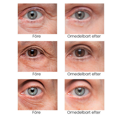 Eye Cream, Eliminates eye bags & wrinkles